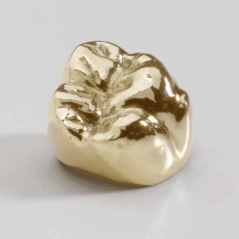 Eurotek Dental Studio Red Bank New Jersey Porcelain Fused Crown